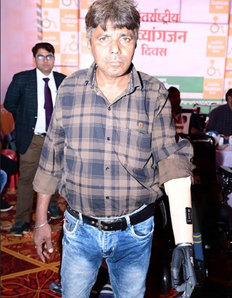 हादसे में मोहन ने गंवाई हाथ, अब कृत्रिम हाथों से काम होगा आसान हादसे में मोहन ने गंवाई हाथ, अब कृत्रिम हाथों से काम होगा आसान