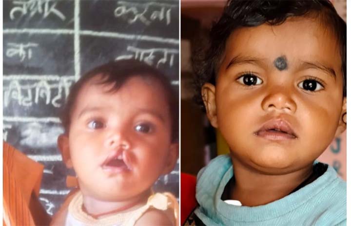 शासन की योजना से दूर हुई बेटी के भविष्य की चिंता, चिरायु दल ने लौटाई मासूम रंजना की मुस्कान शासन की योजना से दूर हुई बेटी के भविष्य की चिंता, चिरायु दल ने लौटाई मासूम रंजना की मुस्कान