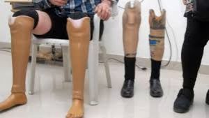 14 जून से 16 जून तक इंडोर स्टेडियम दंतेवाड़ा में होगा जयपुर फूट कैंप का आयोजन 14 जून से 16 जून तक इंडोर स्टेडियम दंतेवाड़ा में होगा जयपुर फूट कैंप का आयोजन