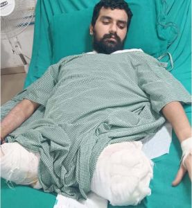 दुर्घटना में कट गये थे दोनों पांव, फिर भी बचा ली जान दुर्घटना में कट गये थे दोनों पांव, फिर भी बचा ली जान