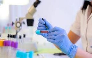 आईसीटीसी लैब टेकनिशियन पद हेतु आवेदन आमंत्रित