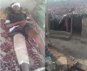  आयुष्मान योजना से बिरहोर आदिवासी युवक को मिला नया जीवन