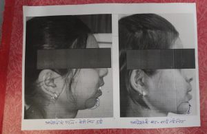  संभाग का पहला टी.जे.आर. और ऑर्थो-ग्रेथिक सर्जरी