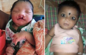  जब चिरायु टीम बनी एक परिवार की उम्मीद