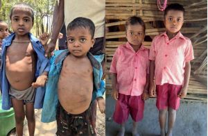  घने जंगलों और नदी-नालों को पार कर स्वास्थ्य दूतों ने बचाई दो मासूमों की जान