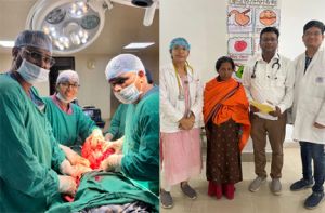 महिला के पेट से निकाला गया 8 किलोग्राम वजनी विशालकाय ट्यूमर