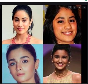    इन स्टारकिड्स ने सुंदर दिखने के लिए करवाई प्लास्टिक सर्जरी