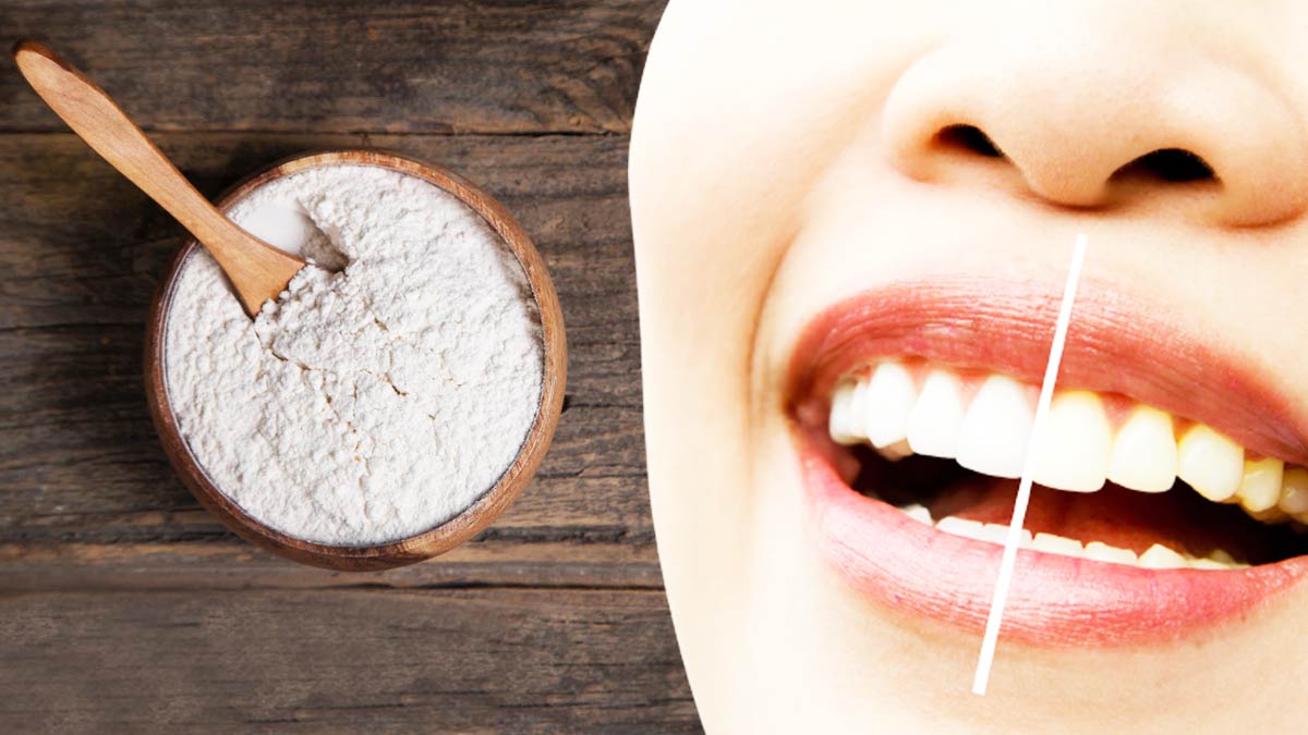 चमकते दांतों के लिए इन तरीकों से इस्तेमाल करें बेकिंग सोडा, स्माइल की होगी तारीफ चमकते दांतों के लिए इन तरीकों से इस्तेमाल करें बेकिंग सोडा, स्माइल की होगी तारीफ
