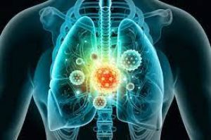  कोरोना के नए स्ट्रेन में मरीजों को क्यों हो रहा है निमोनिया? जानें किन लक्षणों से करें कोविड निमोनिया की पहचान