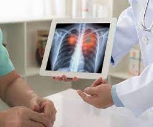  कोरोना मरीजों में देखे जा रहे हैं 'डबल निमोनिया' के मामले,  क्या हैं इसके लक्षण, कारण और इलाज