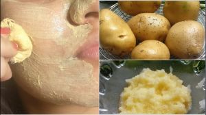  आलू से झाइयां और दाग-धब्बे कैसे मिटाएं? जानें तरीका