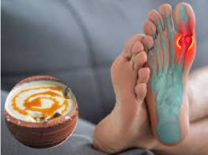  खून में यूरिक एसिड बढ़ा सकते हैं ये 5 फूड्स 