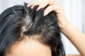   सफेद बालों की समस्या से बचने के लिए आजमाएं ये टिप्स 