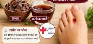  कत्था दूर करेगा फंगल इंफेक्शन की समस्या