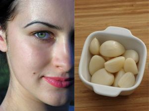 चेहरे से अनचाहे तिल और मस्से हटाने के लिए ऐसे करें लहसुन का इस्तेमाल चेहरे से अनचाहे तिल और मस्से हटाने के लिए ऐसे करें लहसुन का इस्तेमाल