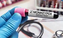 केंद्र ने मंकीपॉक्स पर विशेषज्ञों के साथ बैठक की केंद्र ने मंकीपॉक्स पर विशेषज्ञों के साथ बैठक की