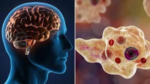 केरल में दिमाग खाने वाले अमीबा से दूसरी मौत..! जानें क्या है नेगलेरिया फाउलेरी