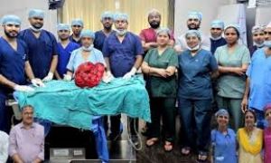 सफदरजंग अस्पताल में चिकित्सकों ने मरीज के पेट से 10 किलोग्राम वजन का ट्यूमर निकाला