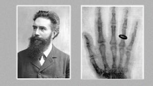   X-Ray की खोज कैसे हुई? जानें शरीर के अंदर देखने वाली इस तकनीक का इतिहास